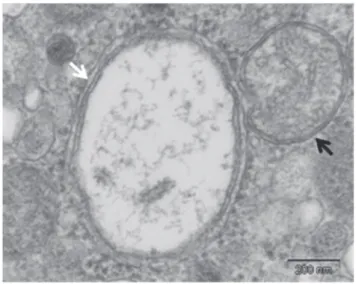 Figure  5   :  Autophagic  vacuoles  in  Drosophila  photoreceptor  observed  by  electron  microscopy