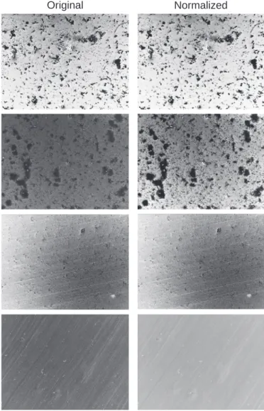 Fig. 2. Example of results of the normalization process on images with different brightness, contrast, and bacteria coverage.