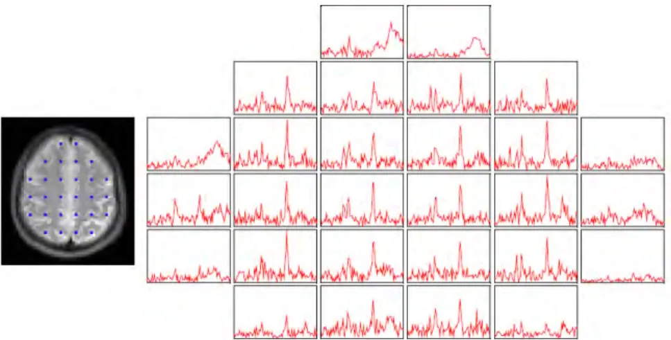 Figure 4.1: Water-suppressed MRSI spectra acquired in a 2D MRSI acqui- acqui-sition from the brain of a healthy human