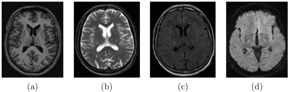 Fig. 2.5 – Diff´ erentes images acquises par IRM : image pond´ er´ ee T1 (image a), T2 (image b), Diffusion (image c) et Flair (image d).