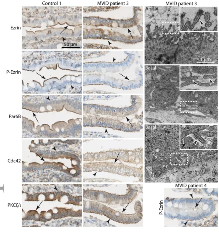 Figure 3: Polarity inversion following MYO5B depletion in 3D grown Caco2 cells 