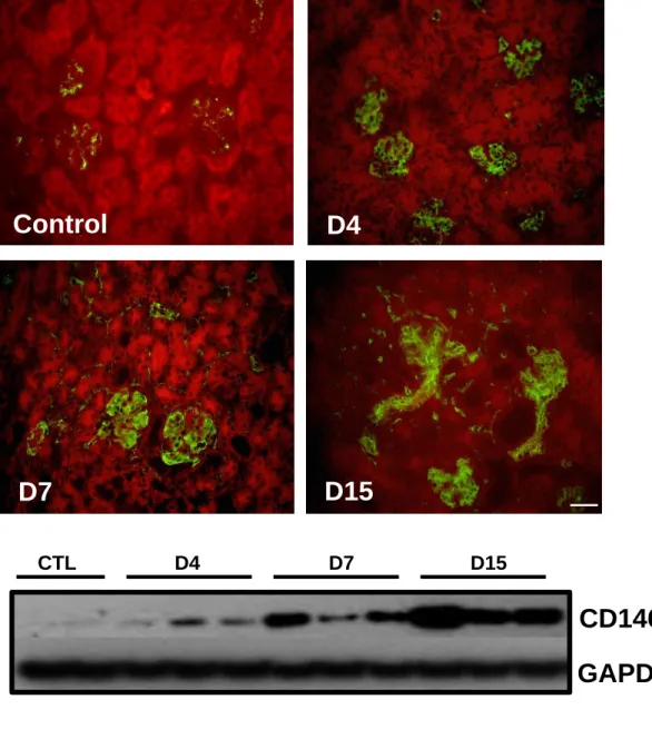 Figure 1 Control  D4 D7  D15  CD146  GAPDH 0 0.2 0.4 0.6 0.8 1 1.2 1.4 1.6 1.8 ** *** CTL D4 D7 D15 CD146/GAPDH* A B C CTL D4 D7 D15 