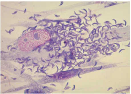 Figure 11 : Lyse de la cellule-hôte et libération des tachyzoïtes. 