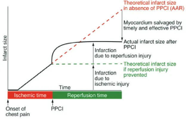 Figure 5. Schematic view of ischemia-induced and reperfusion-induced injuries. AAR: Area  at risk, PPCI: Primary percutaneous coronary intervention