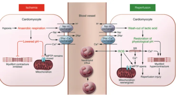 Figure 6. Synthetic view of ischemia and reperfusion consequences on cardiomyocytes. 