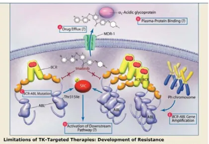 Figure 10 : Les principaux mécanismes de résistance à l’Imatinib : Les mécanismes de résistance sont  soient indépendants de BCR-ABL (augmentation de l’efflux des drogues, séquestration extracellulaire  des  drogues,  activation  de  tyrosine  kinase  seco