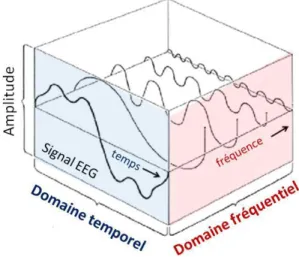 Figure 11 : Représentation du signal EEG dans le domaine temps-fréquence 