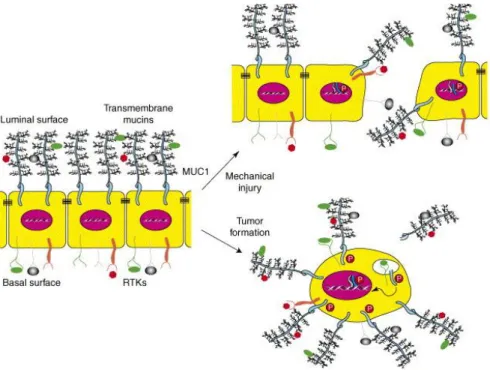 Figure 5 : Rôle anti-adhérent de MUC1 dans le cancer d’après Singh et Al, 2006. 