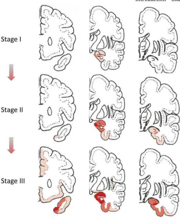 Figure 14 : Stades d’évolution de la pathologie Tau dans l’AGD. Distribution topographique  des grains argyrophiles aux différents stades d’évolution de la pathologie Tau dans trois sections  coronales