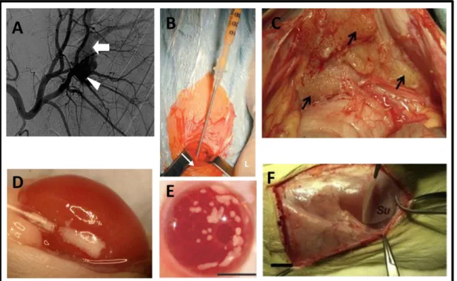 Fig  8:  Different  islet  transplantation  sites.  A)  Intraportal  vein  B)  muscle  C)  Peritoneal  cavity  D)  Under  kindey  capsule  E)  Anterior  chamber  of  eye,  and  F)  Subcutaneous tissue/ epididymal fat pad