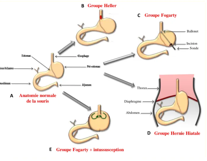 Figure 14: Schématisation des interventions pratiquées chez la souris, A : anatomie normale de  la souris du groupe laparotomie blanche, B  : groupe Heller avec réalisation d’une myotomie au 