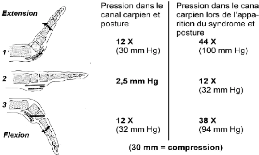 Figure 8 : Représentation de la compression du canal carpien suivant trois postures de la main  (neutre (2), flexion (3), extension (1) (Gelberman 1981)) 