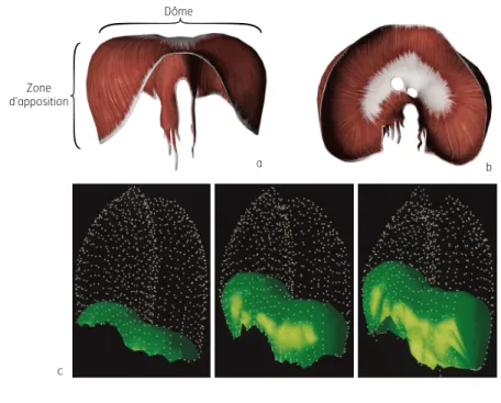 Figure 4. Left anterolateral 3D reconstruction images of the diaphragm (in green) andrib cage (as dots) at(a) TLC,(b) FRC, and (c) RV 