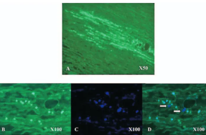 Figure 3. At day 7 after surgical implantation, in both groups, labeled cells were identified in the matrix with PKH67 (green) (A and B) and nuclear counter coloration with 4 =  ,6-diamidino-2-phenylindole (blue) (C) and merged (D)