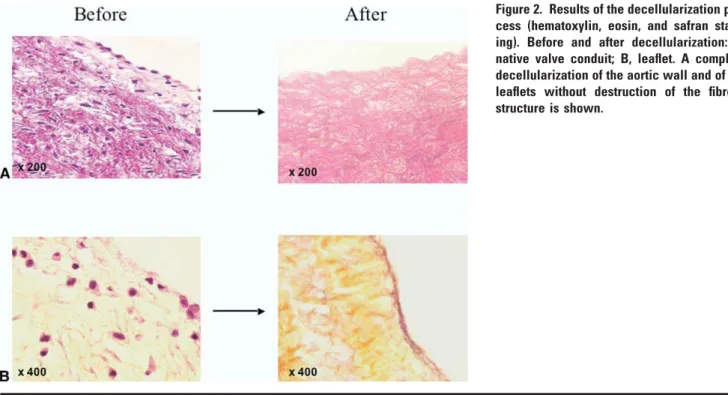 Figure 2. Results of the decellularization pro- pro-cess (hematoxylin, eosin, and safran  stain-ing)