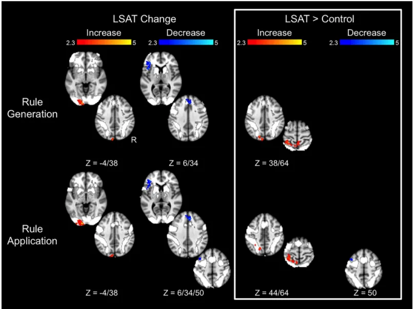 Fig 5. Changes in Letter Series task activation. Results are overlaid on the task activation observed across time points and across groups