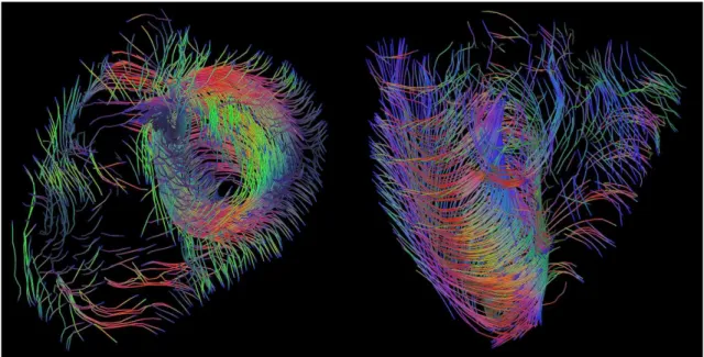 Fig. 1.5. Exemple de tractographie de fibres cardiaques ` a partir du jeu de donn´ ees de la Fig