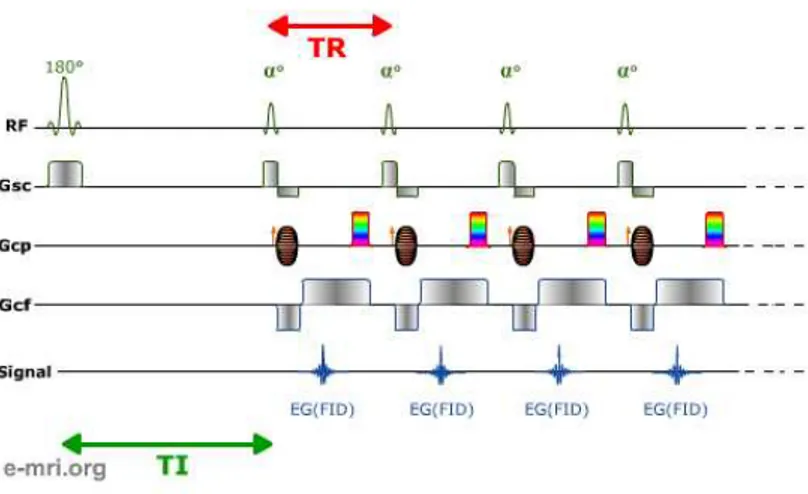 Fig. 2.17. Illustration sch´ ematique du principe d’acquisition avec une s´ equence d’´ echo de gradient ultra-rapide (source : http ://www.e-mri.org/).