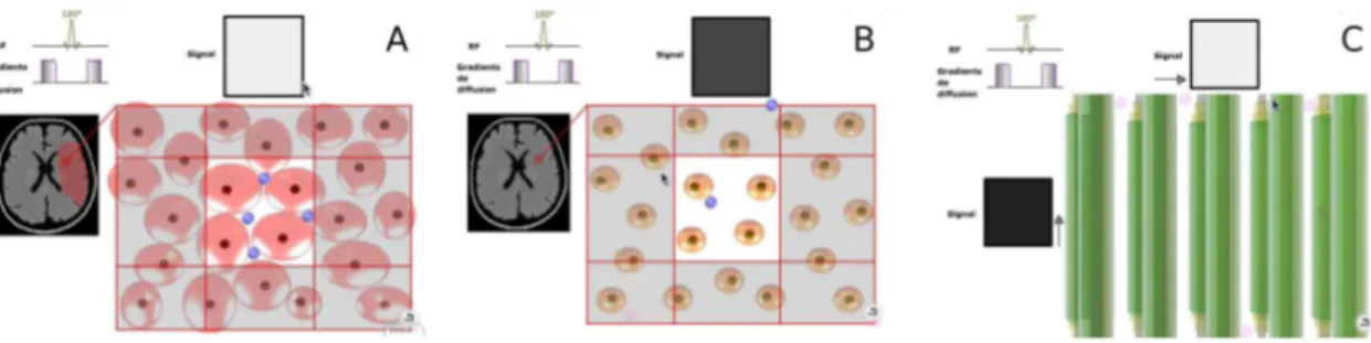 Fig. 2.19. La diffusion des mol´ ecules d’eau dans la direction du gradient conduit ` a une att´ enuation du signal d’´ echo : (A) les mol´ecules d’eau sont immobiles, (B) les mol´ecules d’eau diffusent de mani`ere isotrope, (C) les mol´ecules d’eau diffus