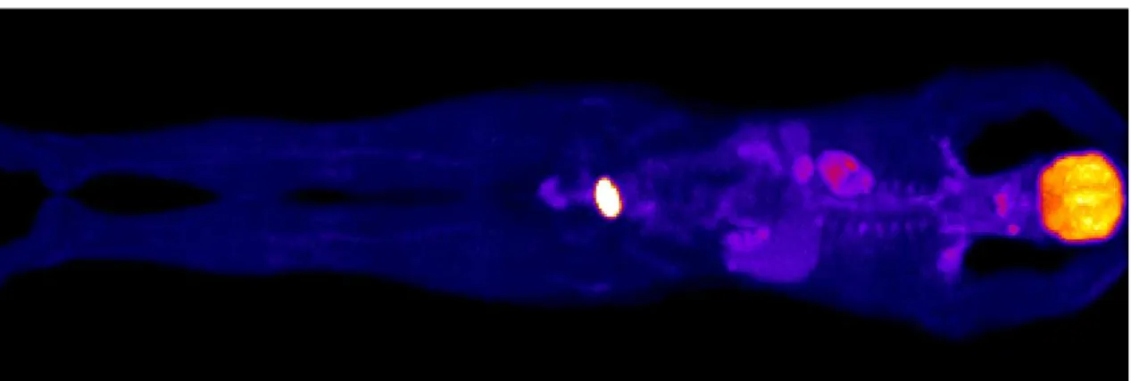 Figure 2.1: 3D whole-body F18-FDG PET scan simulated with GATE, representing ap- ap-proximately 4,000 CPU hours (5.3 months)