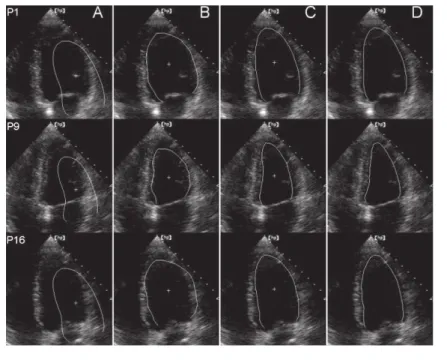 Figure 4.8: Visuals from the AAM of (Bosch et al., 2002) [93] on 3 frames of a single sequence