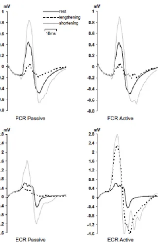 Abbildung 12. MEP-Kurven für den Extensor (ECR) und den Flexor (FCR) carpi radialis in Ruhe, bei Verkürzung  und bei Verlängerung aus der Studie von Chye et al