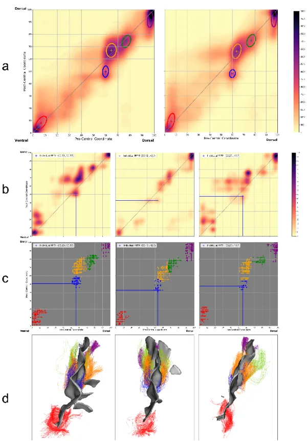 Fig.  4  Extraction  of  U-shape  fibre  bundles  of  the  central  sulcus  by  classifying  associated  group  connectivity  profiles