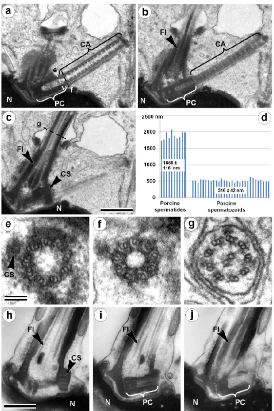 Figure 1. TEM analysis of the neck region of a porcine spermatid with condensed chromatin nucleus  (a–c, e–g) and a mature spermatozoon (h–j)