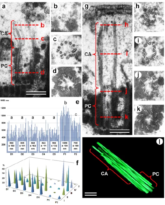 Figure  2.  TEM  analysis  of  the  structure  of  the  proximal  centriole  and  centriolar  adjunct  in  spermatozoa from healthy fertile donors (a–d) and IMS patients (g–k)