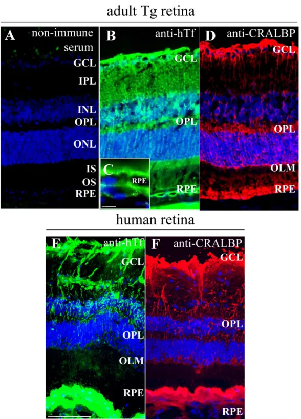 Figure 1. Human transferrin is localized in the same cells in transgenic mice retina as in human retina