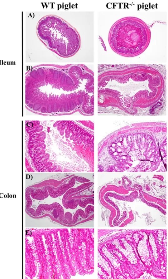Fig 4. Intestinal phenotype of newborn and 13 days old CFTR -/- piglets. H&amp;E staining of WT and CFTR -/- -/-ileum and colon at day 1 [A (x 20) and C (x 100)] and day 13 [B (x 20), D (x 20) and E (x 200)] after birth.