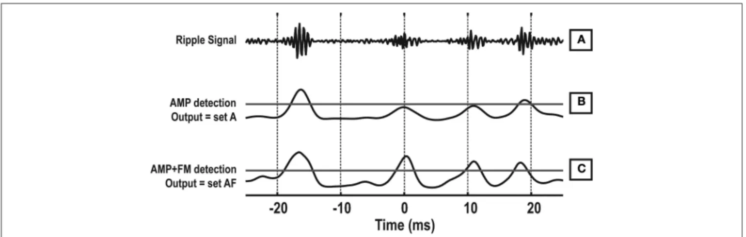 FIGURE 8 | Example of ripple detection using combined frequency and  amplitude information