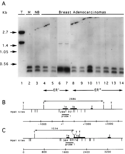 Figure 3 DNA methylation pattern of the 5' region of the BRCA1 gene and pseudogene. (a), DNA extracted from the HeLa cell line was digested with the restriction endonuclease TaqI (T) or by TaqI and MspI (M)