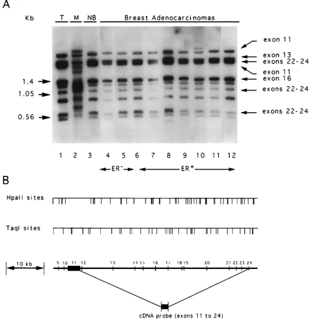 Figure 4 Representative DNA methylation patterns of the BRCA1 3' region. (a) The ®lter was hybridized with probe 2, a cDNA fragment encompassing the end of exon 11 to the end of exon 24