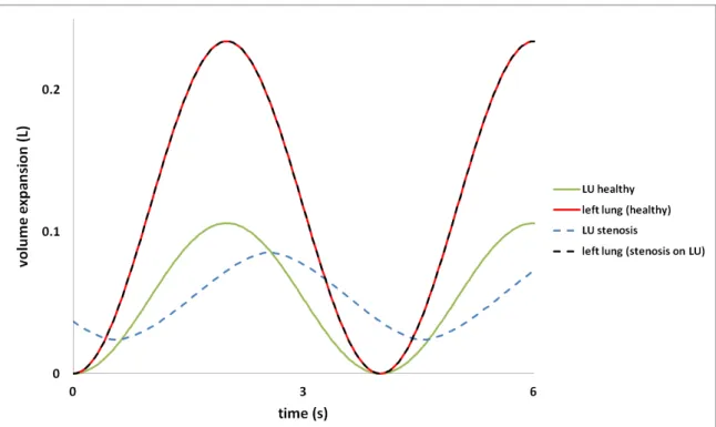 Figure  8:  Left  lung  and  LU  lobe  volume  expansions  from  the  reference  state  in  a  healthy  configuration  and  when  a  bronchoconstriction, with constriction ratio 7, is applied to the branch that feeds lobe LU