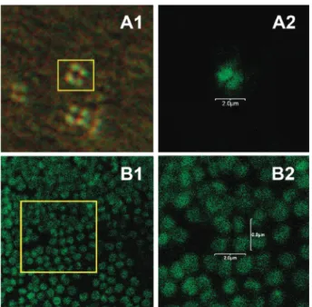 Fig. 7 Confocal laser scanning microscopy (CLSM) pictures of M. lysodeikticus bacteria incubated with 1 (A1 and A2) and 10 mg ml 1 (B1 and B2) of Lys2 for 10 min at 37 1C
