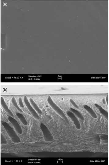 Figure 5. SEM image of the skin (a) and of the cross section (b) of the membrane obtained with 20% w/w CA, 6% CaCl 2 and methyl lactate as a solvent.