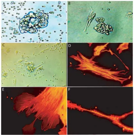 Figure 1. Isolation of Hospicells. A. Cellular aggregates from ascitic fluid of patients with ovarian carcinosis in suspension (6 40)