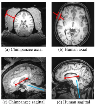 Fig. 1. Human and chimpanzee brain differences. (a) and  (b) axial views show the surrounding tissues of the brain are  thicker in chimpanzee