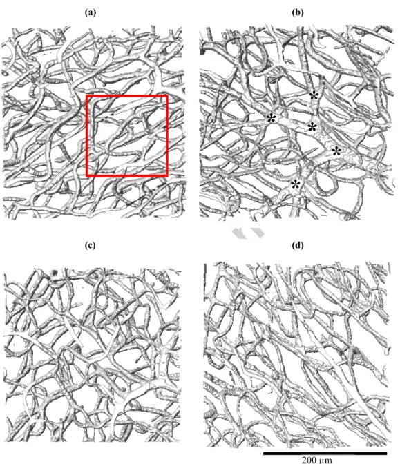 Figure 2: Volume rendering of a selection of representative datasets of healthy intra-cortical networks  from the collateral sulcus in the temporal lobe (a) Capillary mesh in a lateral region of the sulcus (L1) ; (b)  Capillary mesh surrounding the distal 
