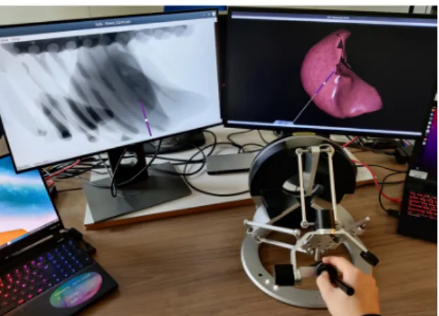 Fig. 4. Trials setup. The user is provided with augmented fluoroscopic image (left) and the registered liver inside of the inverse simulation (right).