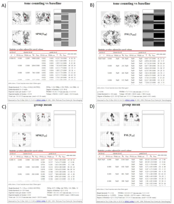 Fig. 1. ​  Examples of SPM HTML display for (A) SPM subject-level analysis, (B) FSL subject-level analysis, (C) SPM  group-level analysis and (D) FSL group-level analysis 