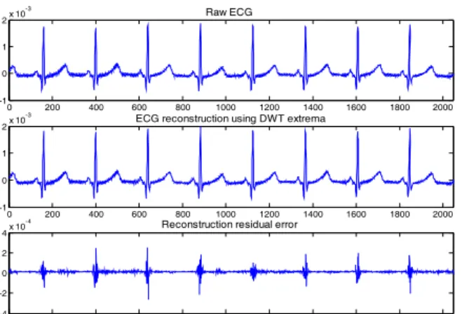 Figure 1 Example of an ECG estimation based on its DWT extrema (MIT-BIH records 108). 