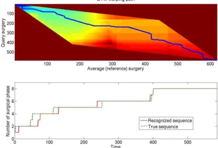 Fig. 3. Distance map of two surgeries and dedicated warping path using the Itakura constraint  (up), along with the transposition of the surgical phases (down)