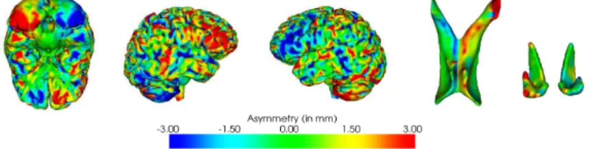 Fig. 3. Individual asymmetry mapping on a given subject. Left to right: brain cortex, lateral ventricles and caudate nuclei