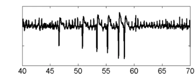 Fig 6 : Portion d’un signal SEEG contenant une décharge  rythmique de pointes 