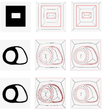 Fig. 9 Three slices of a volume representing a heart and their respec- respec-tive Medial Axis