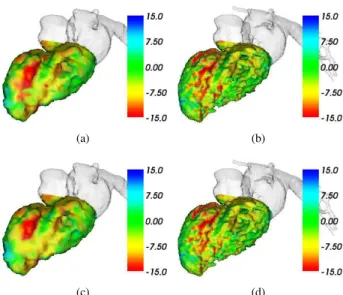 Figure 1 illustrates an example of results obtained at the two lowest resolution levels (R 1 with volume size 64 3 and R 2 (128 3 ))