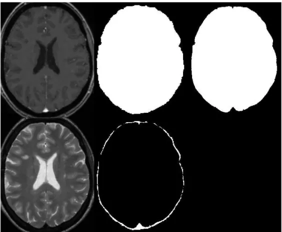 Figure 1: Example of brain mask extraction. Top line, from left to right: T1-w, result of bet and final result