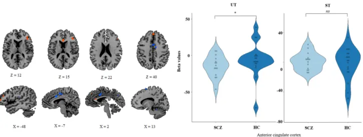 Fig. 4    Entire group ST–UT. In this display, we report the brain map  for the whole population during conscious access to visual input [ST–